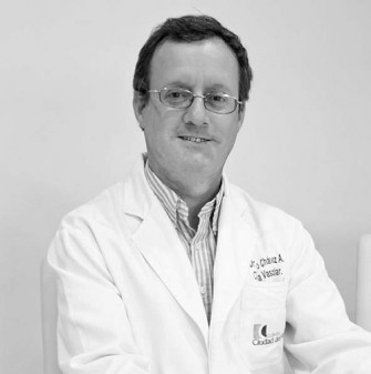Estética o problema de salud, Várices